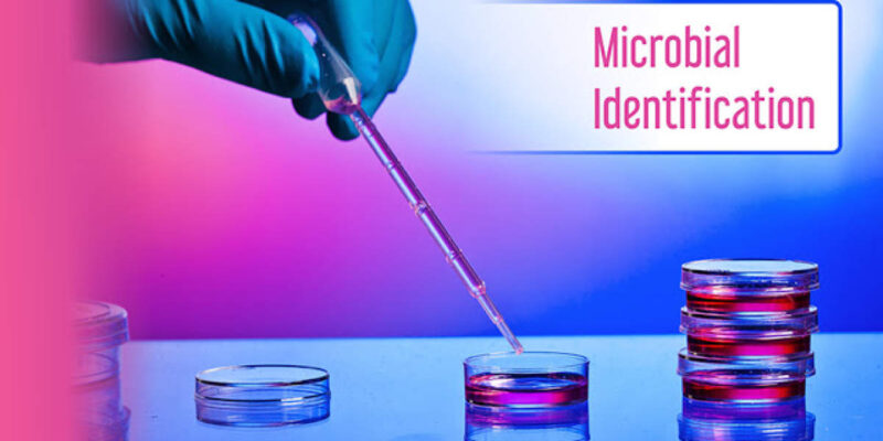 Microbial Identification Market ,