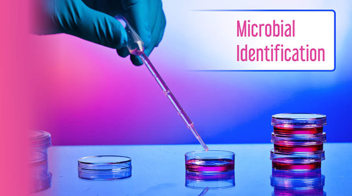 Microbial Identification Market ,